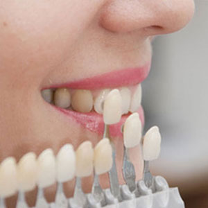 woman choosing veneer colour in Vancouver